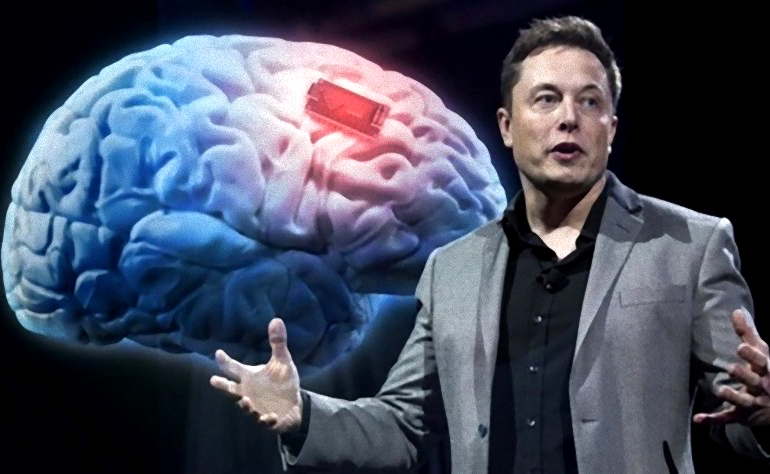 Tiết lộ cỗ máy cấy chip vào não người của Elon Musk
