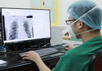 Công nghệ AI được sử dụng trong phòng chống lao phổi tại Việt Nam