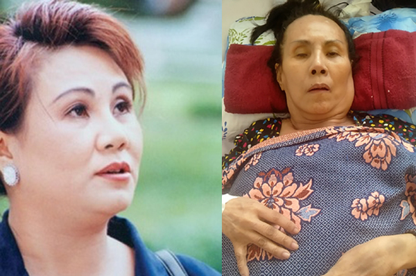 Nghệ sĩ Hoàng Lan bị bệnh đến hoại tử, người thân cầu cứu