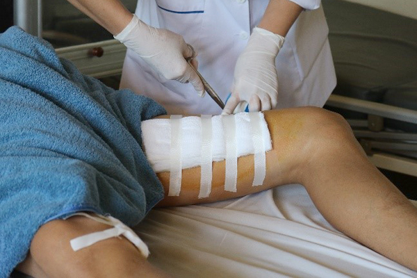 Bình rượu 20 lít phát nổ khi mở, nam thanh niên đứt cơ đùi