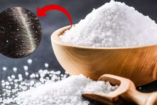 Mùa đông tóc rụng nhiều và có gàu? Áp dụng ngay cách gội đầu bằng nước muối để cải thiện, vừa rẻ lại hiệu quả