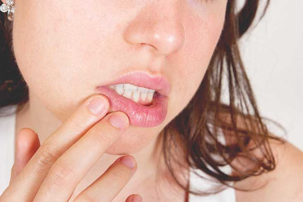 Bảy dấu hiệu của đôi môi hé lộ bệnh tiềm ẩn trong cơ thể