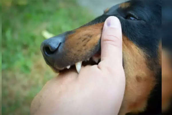 Bị chó cắn, người đàn ông phát dại chui gầm giường và tử vong