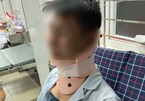 Người đàn ông bị đánh nhập viện sau va chạm giao thông ở Hà Nội