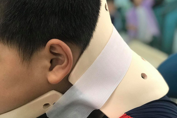 Bé trai 10 tuổi vẹo cổ vì bắt chước video nhào lộn trên mạng