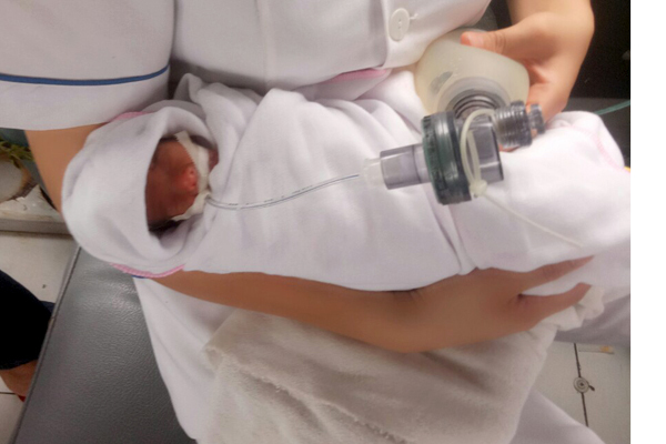 Chị song sinh mất, bé gái sơ sinh 480g ở Vĩnh Phúc sống sót kỳ diệu