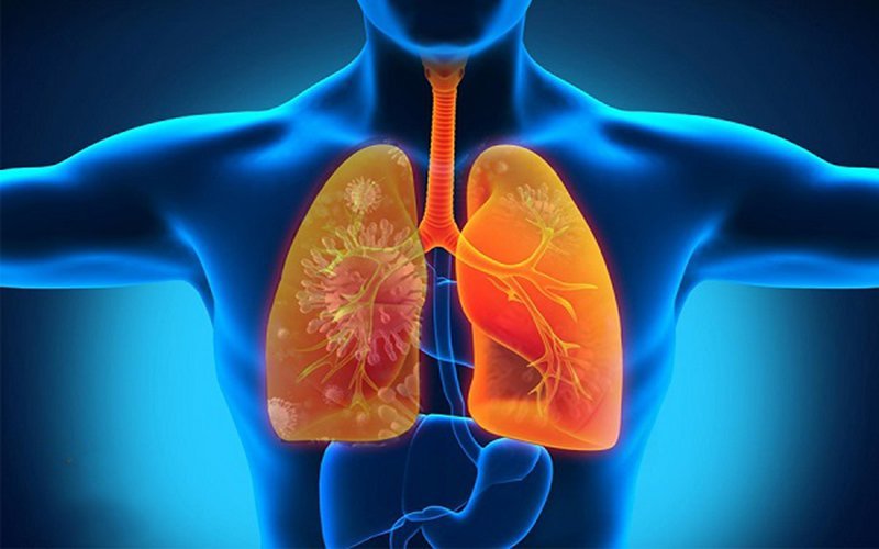 Ngăn chặn một bệnh lý thuộc nhóm nguyên nhân hàng đầu gây tử vong