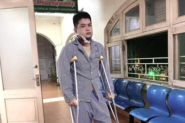 Diễn viên Long Chun bị u xương hàm phải dừng thi Gương mặt thân quen