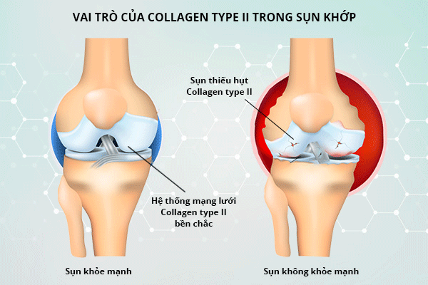 Bất ngờ bị sa thải