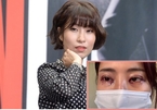 Diễn viên hài Hàn Quốc 31 tuổi 'dao kéo' thay đổi diện mạo
