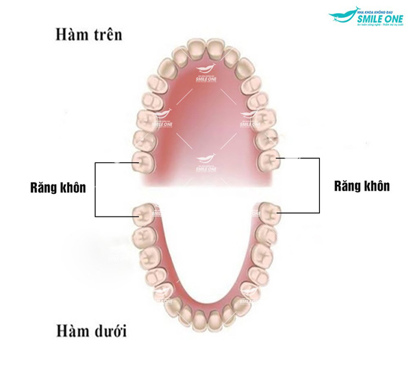 Giảm bớt nỗi sợ đau khi nhổ răng khôn với công nghệ Piezotome