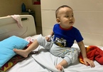 Bé trai 2 tuổi bị ung thư máu mong có cơ hội được sống