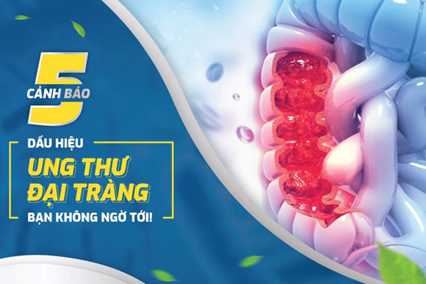 5 dấu hiệu cảnh báo sớm nguy cơ ung thư đại trực tràng