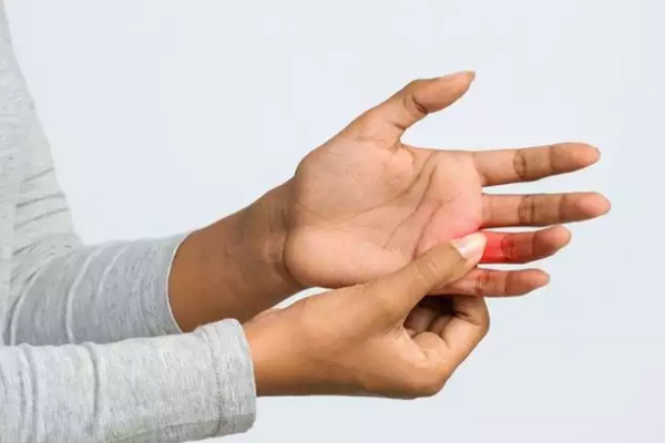 Năm triệu chứng bất thường của bệnh nhân Covid-19