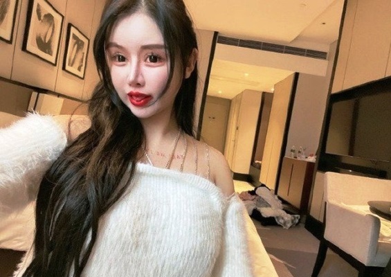 Cô gái trải qua 100 lần can thiệp thẩm mỹ trong vòng 3 năm