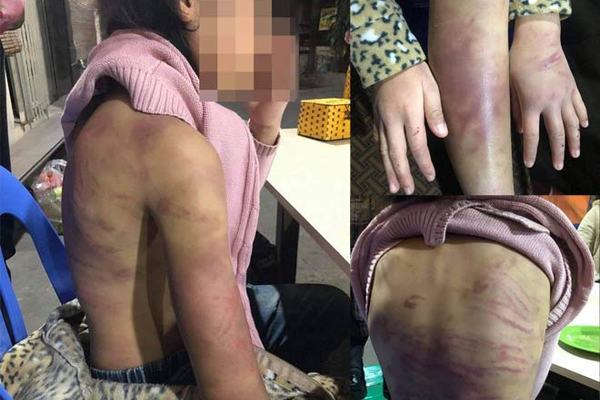 Bé gái nói về việc bị mẹ trói tay chân đánh đập ở Hà Nội