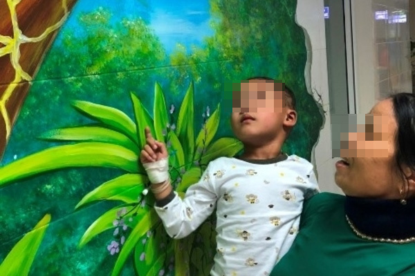 Bé 4 tuổi bị chó cắn hở sọ não