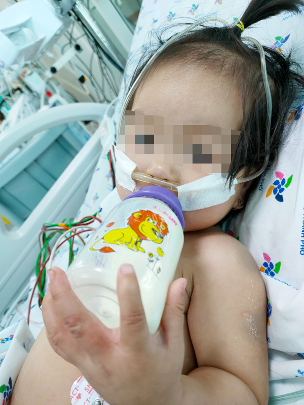 Bé gái 15 tháng tuổi nguy kịch vì biến chứng tay chân miệng