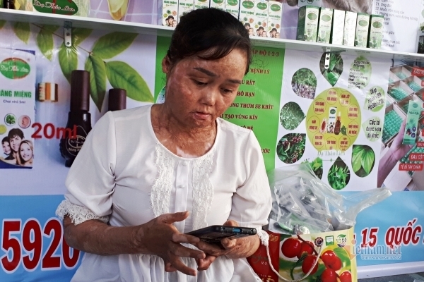 Người vợ bị chồng thiêu sống hồi sinh cuộc đời nhờ thương con vô bờ bến