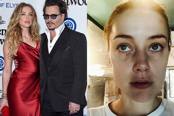 Johnny Depp bị tung bằng chứng 12 lần đánh Amber Heard
