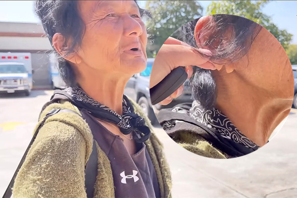 Nghệ sĩ Thúy Nga hoảng hồn phát hiện ca sĩ Kim Ngân bị rách tai