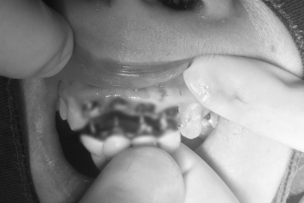 Răng sứ có màu sắc và hình dạng tự nhiên như răng thật không?
