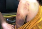 8 thiếu nữ bị đánh, chích điện ép bán dâm trong quán karaoke