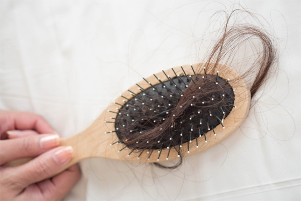 Bệnh lạ khiến người phụ nữ rụng tóc, hói nửa đầu
