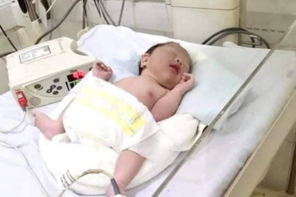 Bị chồng bỏ rơi, vợ trẻ ôm con sơ sinh dị tật xin giúp đỡ