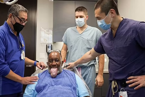 Biến chứng lưỡi khổng lồ ở bệnh nhân Mỹ sau khi khỏi Covid-19