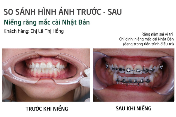 Truyện Ngỡ Là Yêu Thương