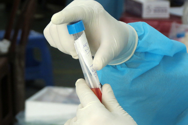 Nghệ An có ca dương tính nCoV tử vong đầu tiên