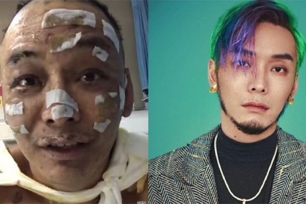 Nam rapper Trung Quốc bị bỏng nặng sau vụ cháy nhà