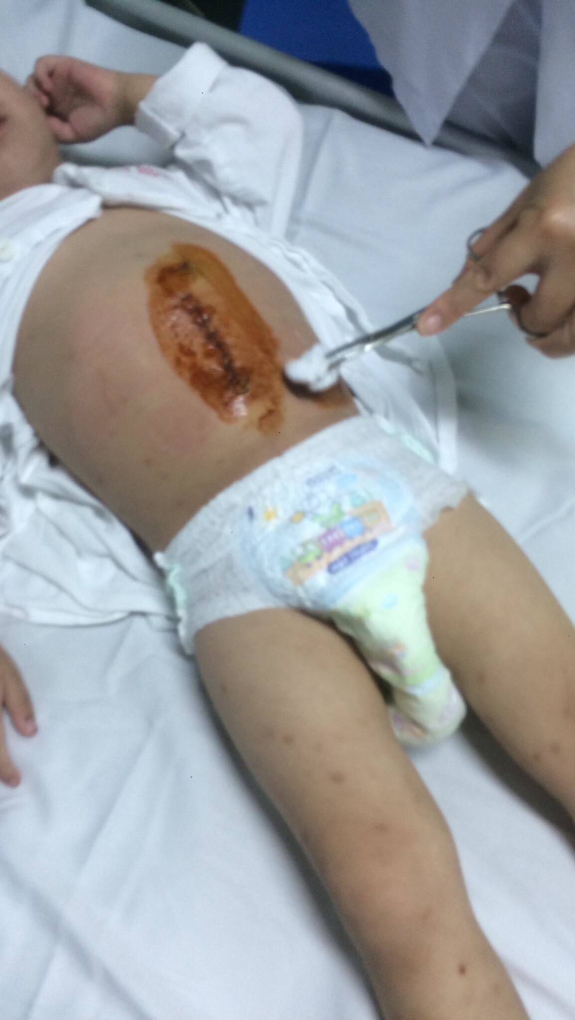 Bé trai 3 tuổi đau đớn vật vã do mắc căn bệnh lạ về máu