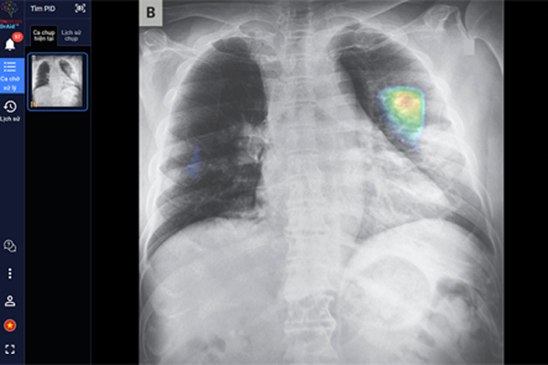 VinBrain giành giải thưởng quốc tế Sản phẩm AI xuất sắc nhất 2021