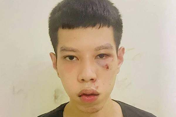Bắt giữ thanh niên Hà Nội cướp 16 triệu của cụ bà vừa lĩnh lương hưu