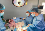 Sự thật bức ảnh 2 em bé sinh đôi trong vụ bác sĩ rút máy thở