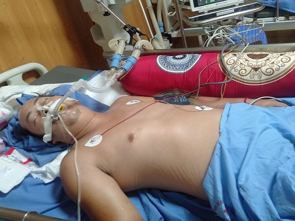 Cha nghèo vỡ mạch máu não, con thơ nguy cơ sống cảnh mồ côi