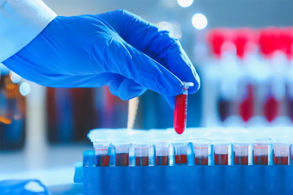 Một thói quen phổ biến làm giảm tác dụng của vắc xin Covid-19