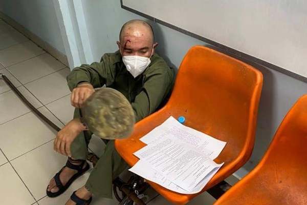 Bắt đối tượng tông xe khiến cảnh sát bị thương nặng