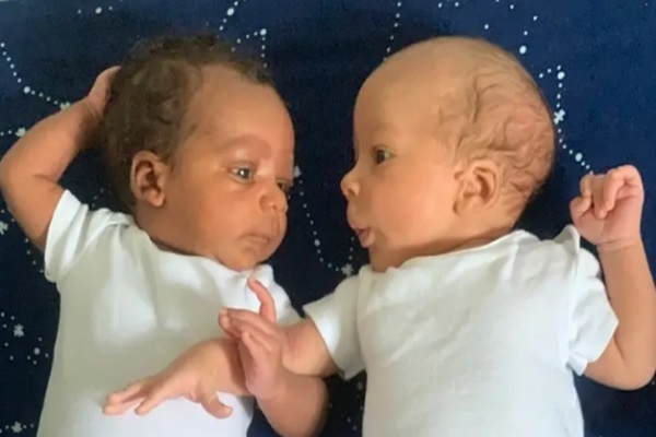 Cặp sinh đôi một da đen, một da trắng