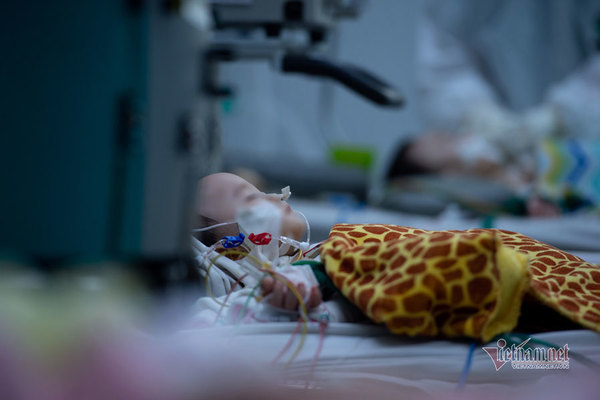 Doctors try to save seriously ill Covid-19-infected children