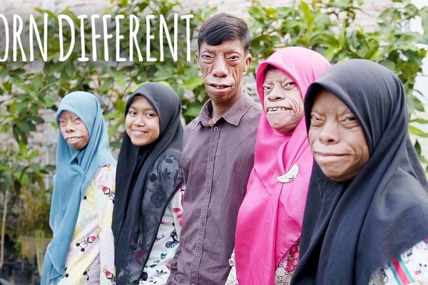 Bí ẩn gia đình có bốn người mang khuôn mặt 'hình cá'