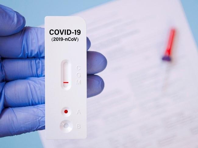 Bộ Y tế nói gì về test nhanh Covid-19 mua tại nước ngoài giá 1,5 USD?