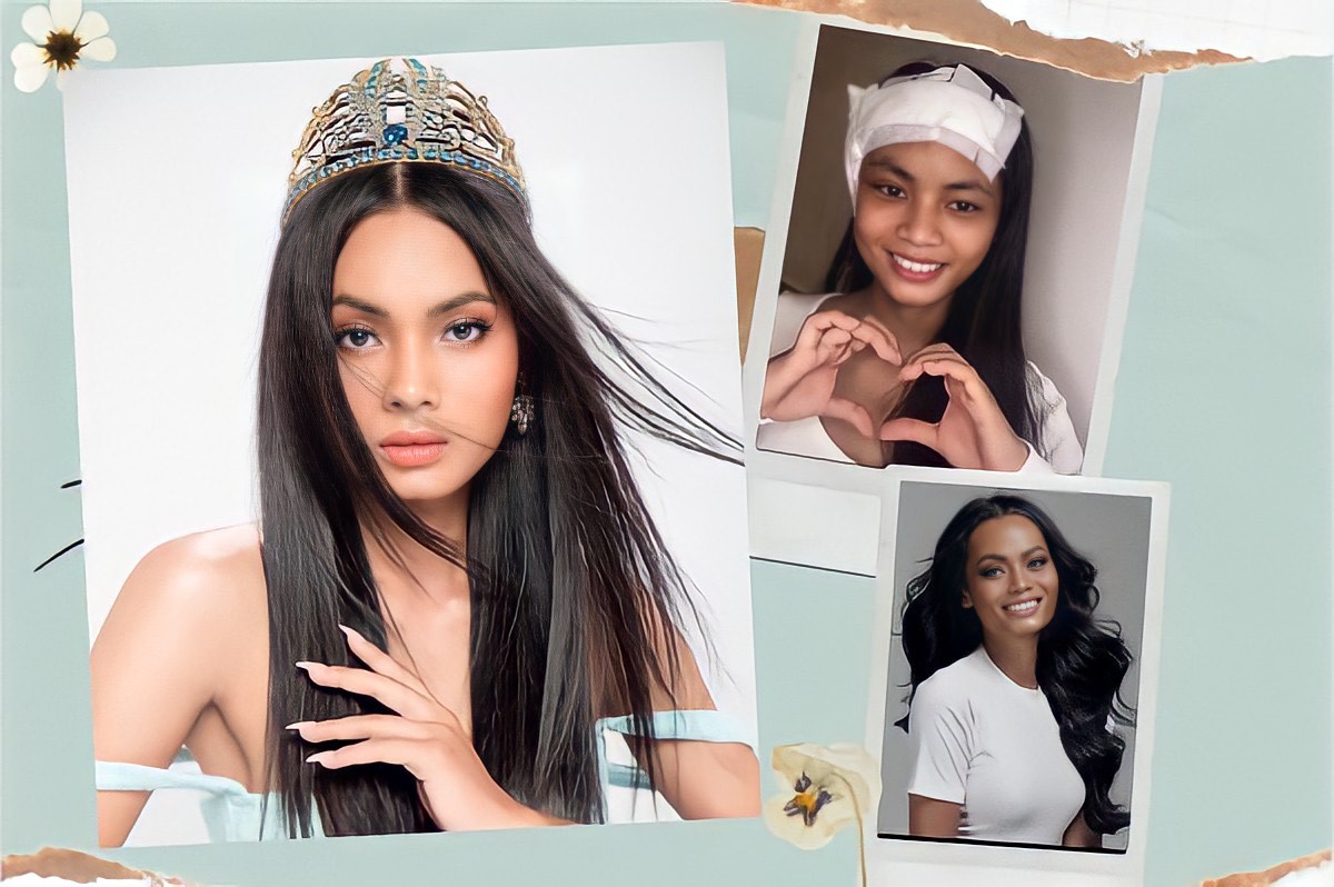 Người mẫu Châu Kim Sang bị viêm màng não, ung thư xương di căn giờ ra sao?