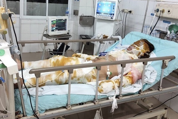 Trao hơn 55 triệu đồng đến chị Lê Thị Tâm bị bỏng nặng