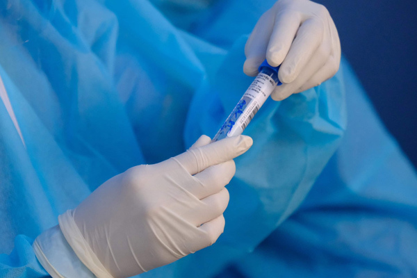 TP.HCM công khai giá xét nghiệm Covid-19 ở cơ sở công lập, tư nhân
