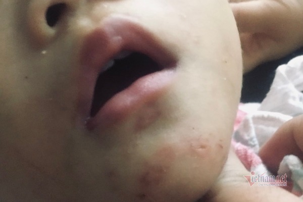 Công an làm việc với người tố cáo vụ bé gái 16 tháng bị bạo hành