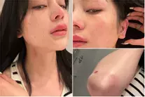 Lily Chen tung ảnh bị hành hung, ám chỉ nữ hoàng nội y?