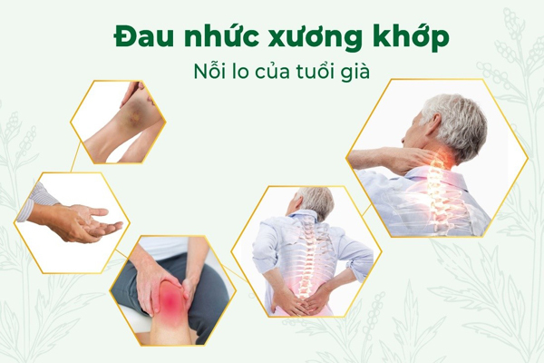 Giảm nỗi lo đau nhức cơ xương khớp với bí quyết từ Dược Nam Hà